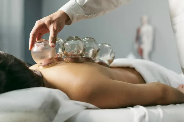 Cupping for Muscle Recovery