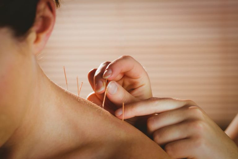 Acupuncture in dubai